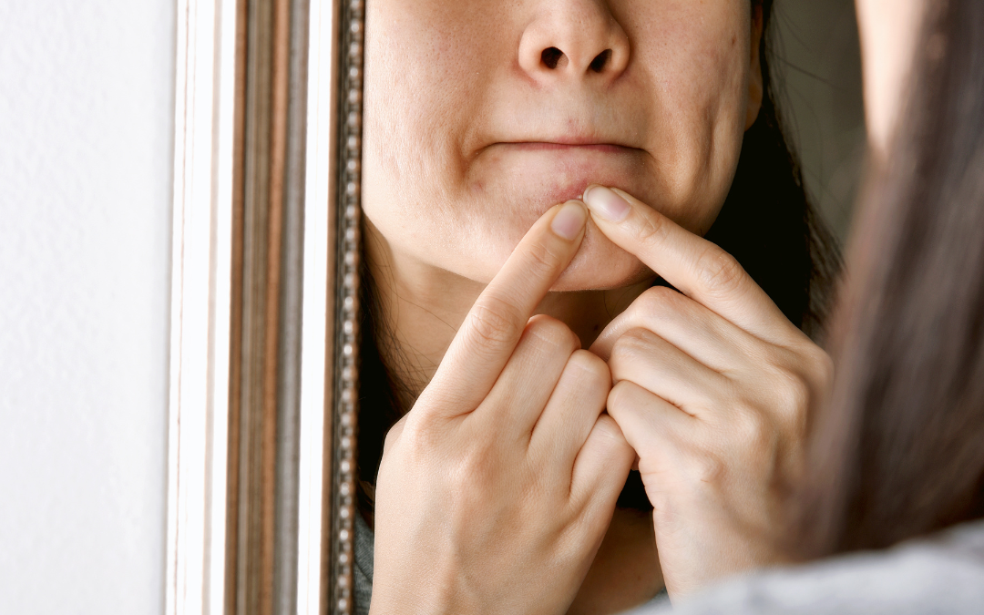 How To Stop Skin Picking DocVita